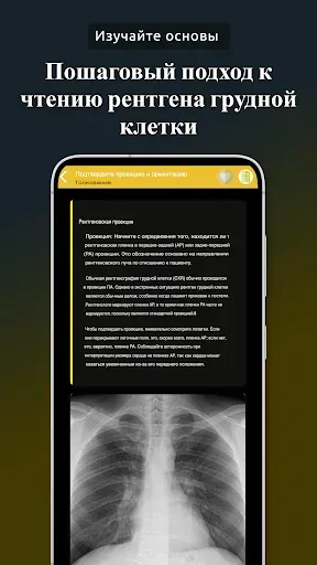 Скриншот 4 — Рентген грудной клетки, РГ ОГК
