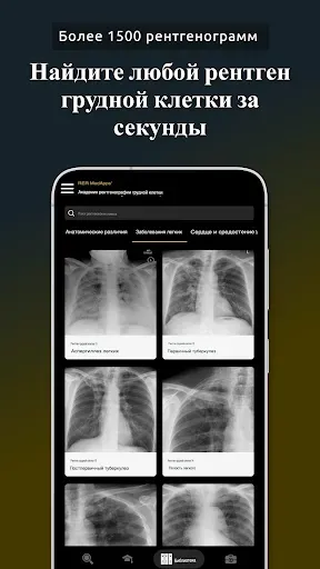 Скриншот 6 — Рентген грудной клетки, РГ ОГК