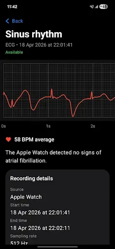Скриншот 6 — Merge - Apple Watch to Android
