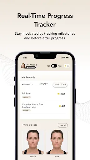 Скриншот 7 — myolift