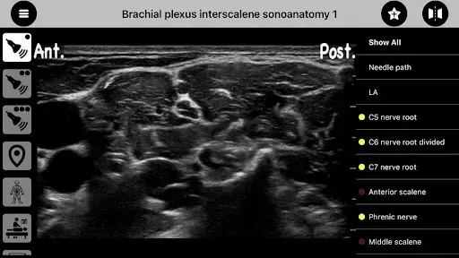 Скриншот 3 — AnSo Anaesthesia Sonoanatomy