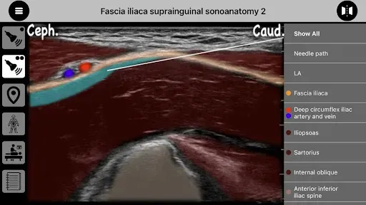 Скриншот 4 — AnSo Anaesthesia Sonoanatomy