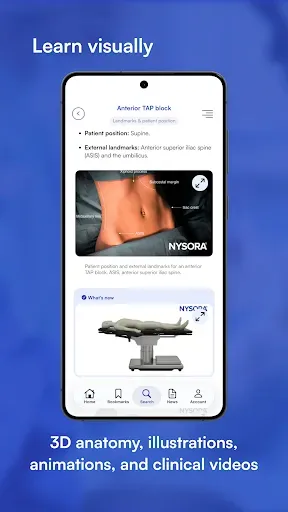 Скриншот 3 — NYSORA Nerve Blocks