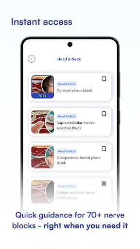 Скриншот 4 — NYSORA Nerve Blocks