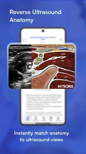 Скриншот 5 — NYSORA Nerve Blocks