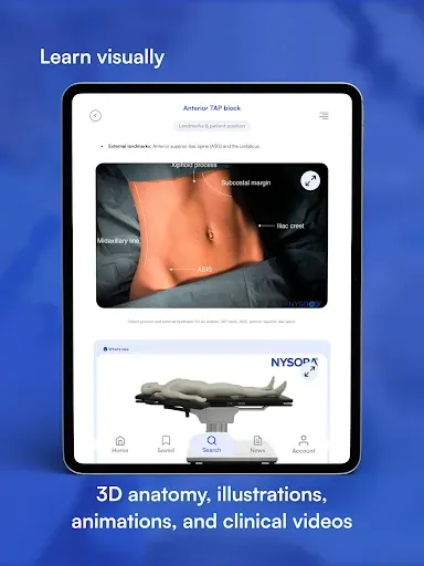 Скриншот 8 — NYSORA Nerve Blocks