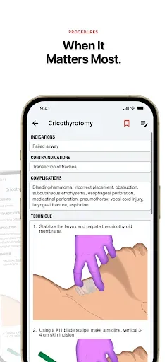 Скриншот 3 — palmEM AI: EM Quick Reference