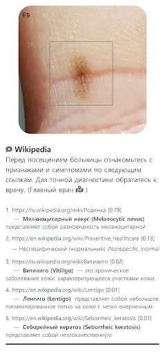 Скриншот 1 — Model Dermatol – Болезнь кожи
