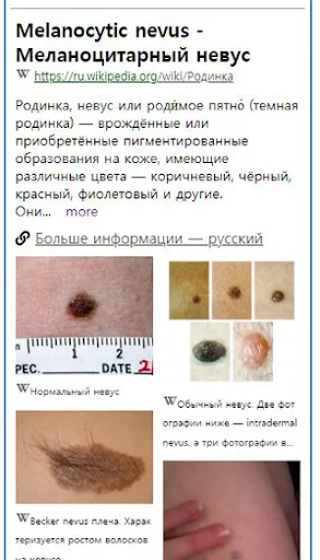 Скриншот 2 — Model Dermatol – Болезнь кожи