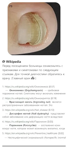 Скриншот 3 — Model Dermatol – Болезнь кожи
