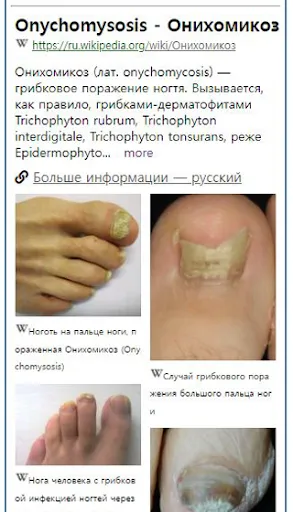 Скриншот 4 — Model Dermatol – Болезнь кожи