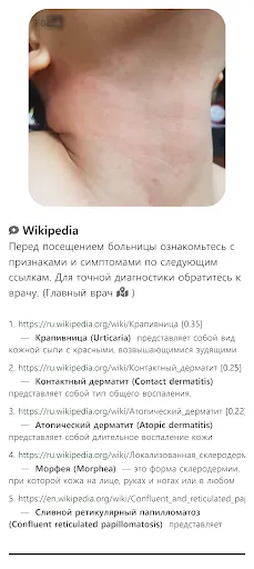 Скриншот 5 — Model Dermatol – Болезнь кожи