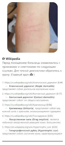 Скриншот 6 — Model Dermatol – Болезнь кожи