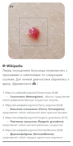 Скриншот 7 — Model Dermatol – Болезнь кожи