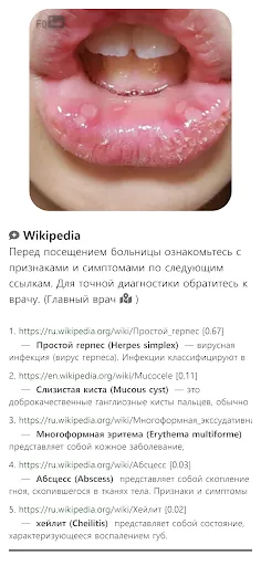 Скриншот 8 — Model Dermatol – Болезнь кожи