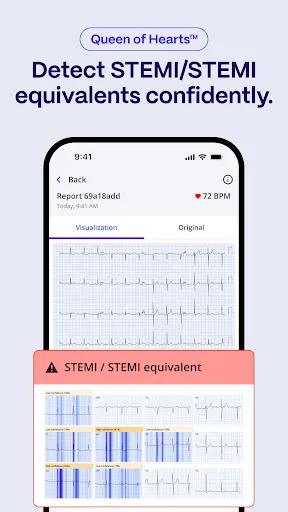 Скриншот 3 — PMcardio for Individuals