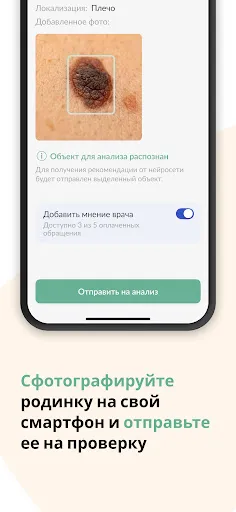 Скриншот 1 — Про Родинки: здоровая кожа