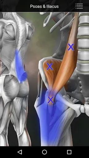 Скриншот 3 — Muscle Trigger Point Anatomy