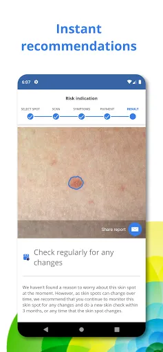 Скриншот 3 — SkinVision - Find Skin Cancer