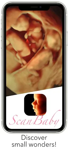Скриншот 1 — ScanBaby learn baby ultrasound