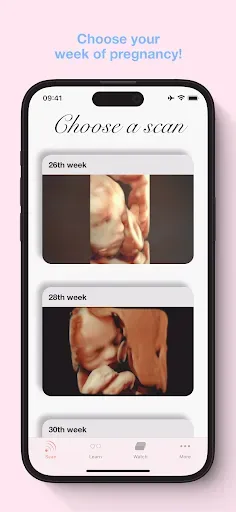 Скриншот 2 — ScanBaby learn baby ultrasound