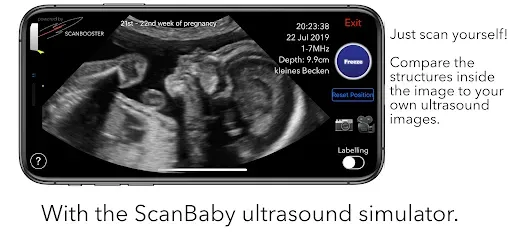 Скриншот 3 — ScanBaby learn baby ultrasound