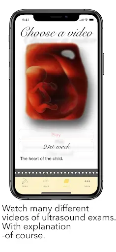 Скриншот 4 — ScanBaby learn baby ultrasound