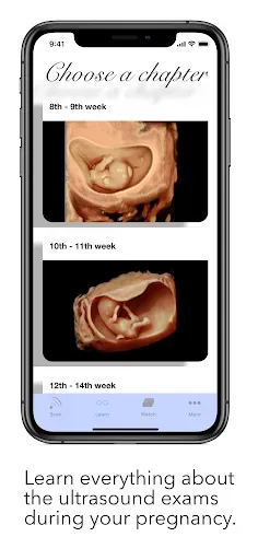 Скриншот 5 — ScanBaby learn baby ultrasound