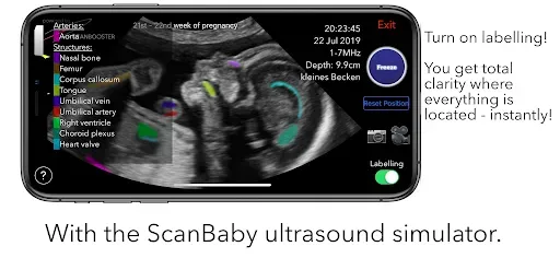 Скриншот 6 — ScanBaby learn baby ultrasound