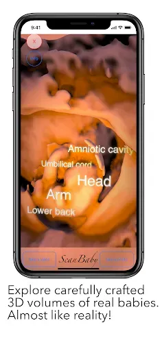 Скриншот 7 — ScanBaby learn baby ultrasound
