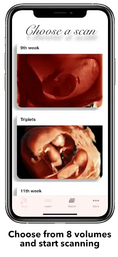 Скриншот 8 — ScanBaby learn baby ultrasound