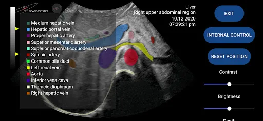 Скриншот 1 — Scanbooster Ultrasound Sim