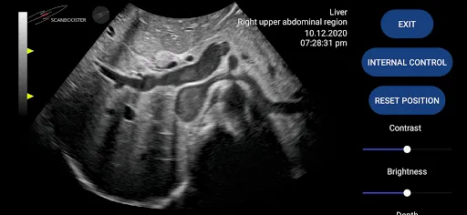 Скриншот 2 — Scanbooster Ultrasound Sim