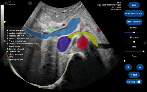 Скриншот 6 — Scanbooster Ultrasound Sim