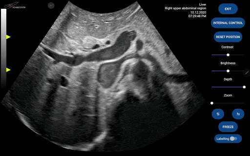 Скриншот 7 — Scanbooster Ultrasound Sim