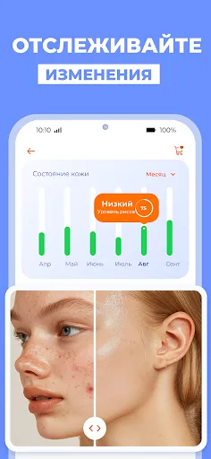 Скриншот 6 — Сканер кожи: Здоровье, красота