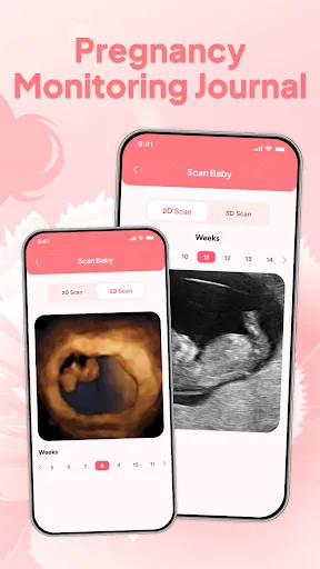 Скриншот 4 — Pregnant & Baby Health Tracker