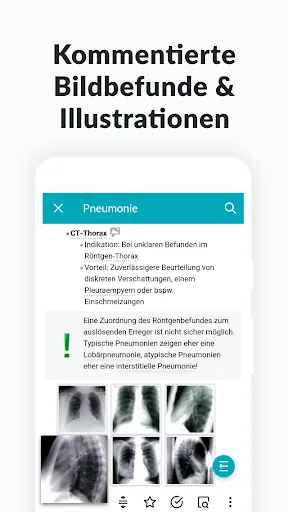 Скриншот 7 — AMBOSS Wissen für Mediziner