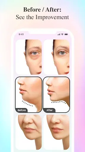 Скриншот 2 — Faceform · Face Yoga Exercise