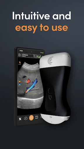 Скриншот 1 — Clarius Ultrasound