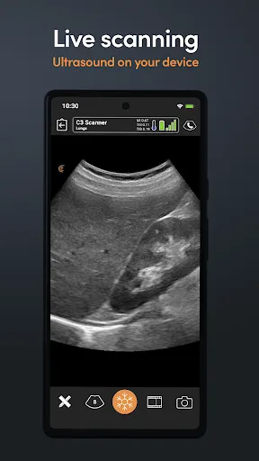 Скриншот 2 — Clarius Ultrasound