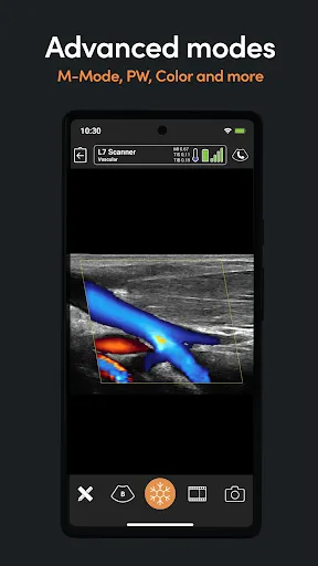 Скриншот 4 — Clarius Ultrasound