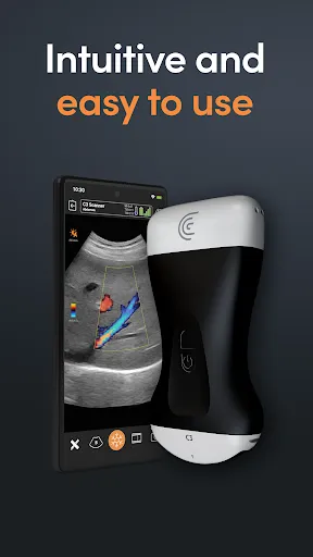 Скриншот 6 — Clarius Ultrasound
