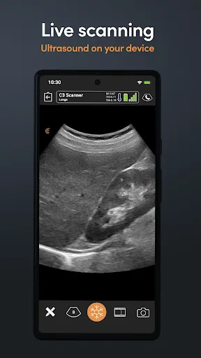 Скриншот 7 — Clarius Ultrasound