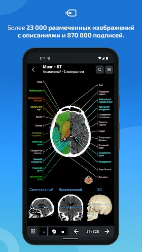 Скриншот 2 — IMAIOS e-Anatomy
