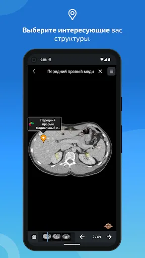 Скриншот 4 — IMAIOS e-Anatomy