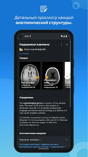 Скриншот 5 — IMAIOS e-Anatomy