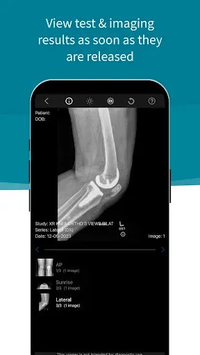 Скриншот 4 — Stanford Health Care MyHealth